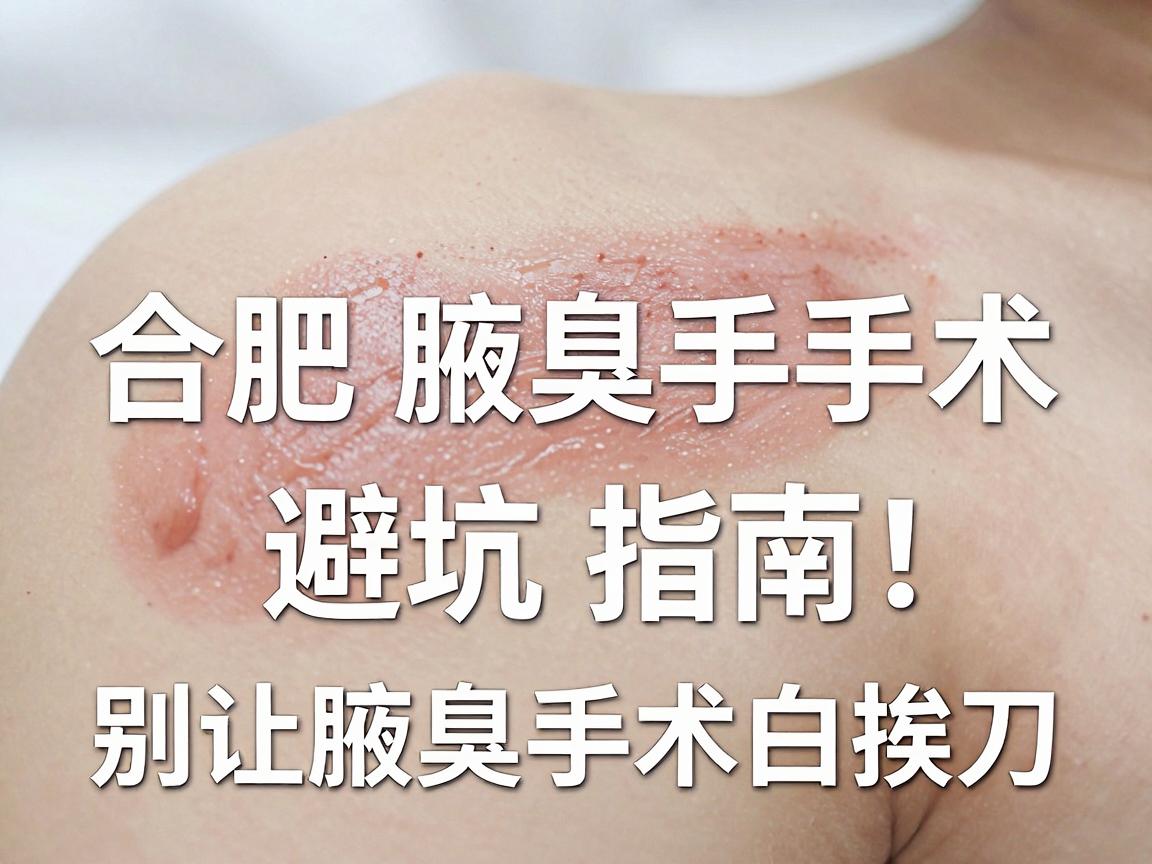 合肥腋臭手术怎么选？合肥腋臭手术医院避坑指南，别让腋臭手术白挨刀