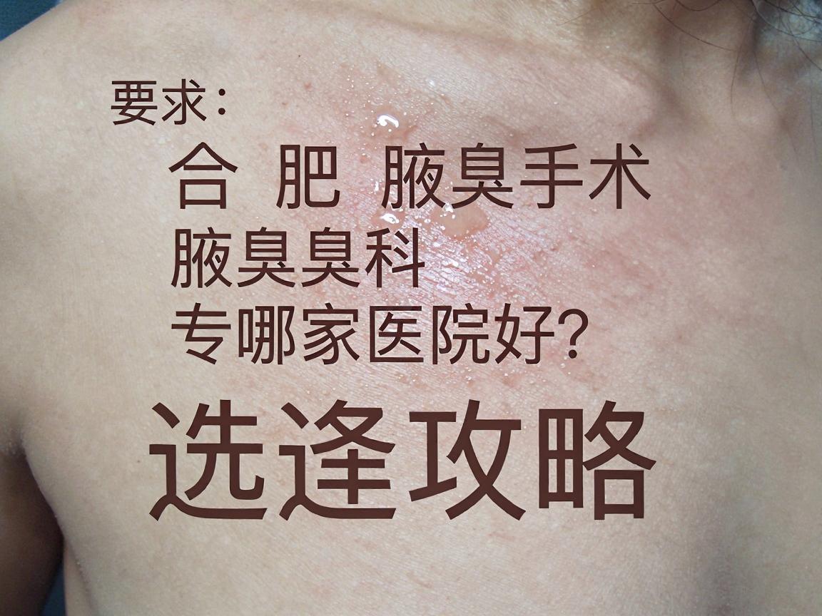 合肥腋臭手术哪家医院好？合肥腋臭专科医院选择攻略