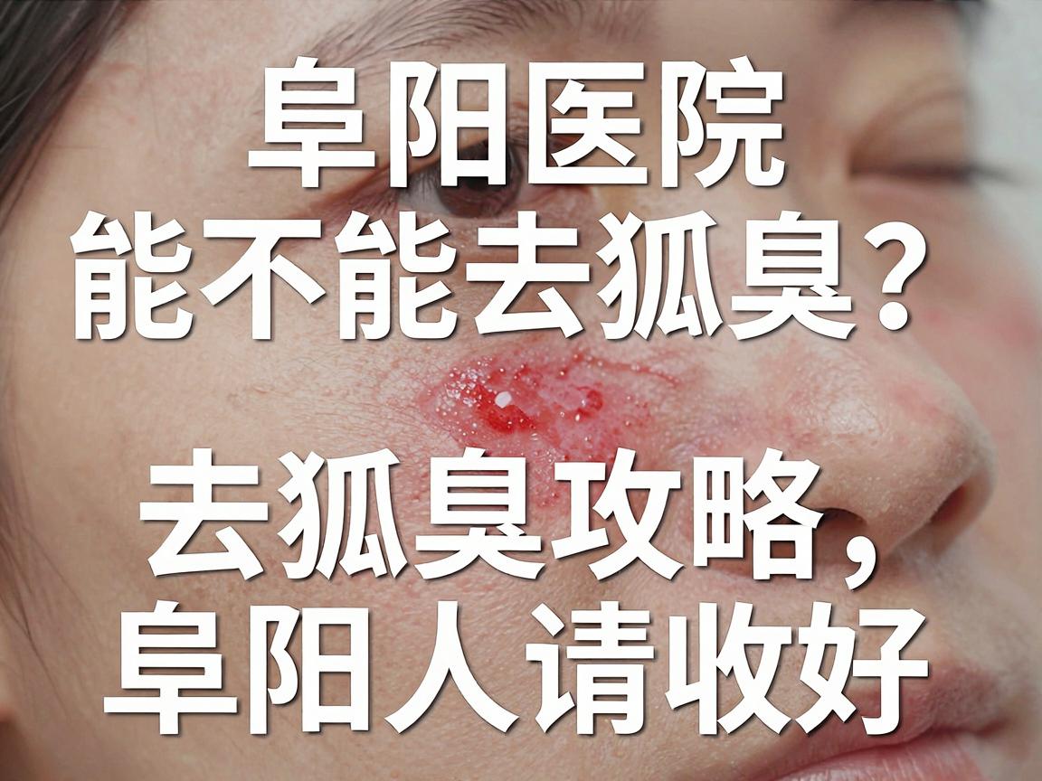阜阳医院能不能去除狐臭？这份去狐臭攻略，阜阳人请收好