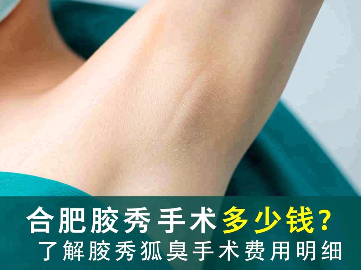 合肥腋秀腋臭手术多少钱？了解腋秀狐臭手术费用明细