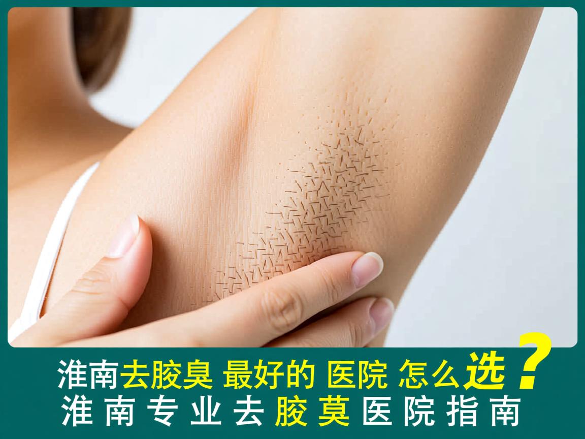 淮南去腋臭最好的医院怎么选？淮南专业去腋臭医院指南