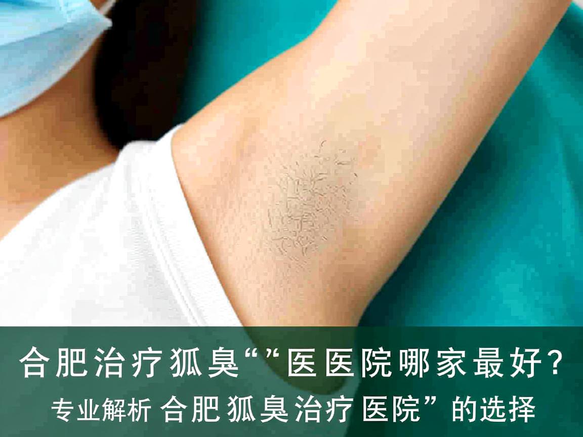 合肥治疗狐臭的医院哪家最好？专业解析合肥狐臭治疗医院的选择
