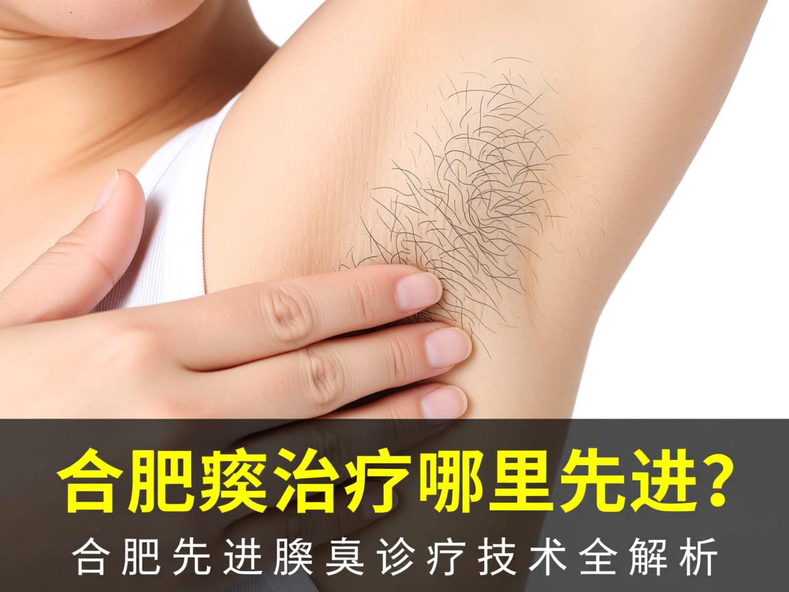 合肥腋臭治疗哪里先进？合肥先进腋臭诊疗技术全解析