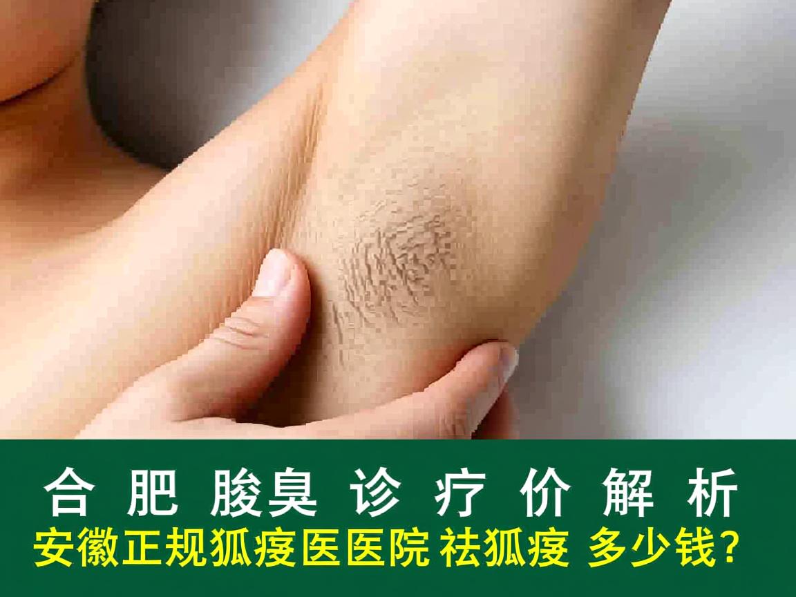 合肥腋臭诊疗价格解析,安徽正规狐臭医院祛狐臭多少钱? 合肥腋臭诊疗价格解析,安徽正规狐臭医院祛狐臭多少钱?
