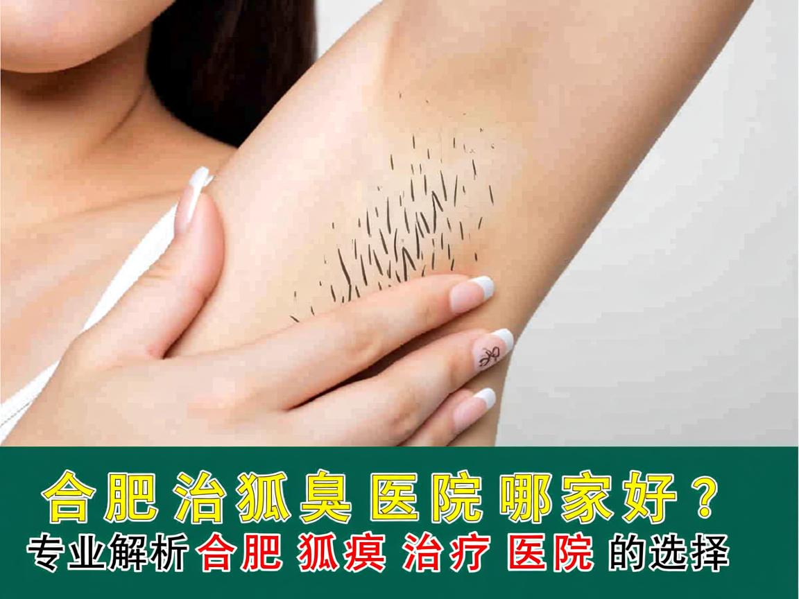 合肥治狐臭医院哪家好？专业解析合肥狐臭治疗医院的选择
