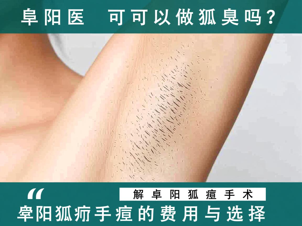 阜阳医院可以做狐臭吗?解析阜阳狐臭手术的费用与选择 阜阳医院可以做狐臭吗?解析阜阳狐臭手术的费用与选择