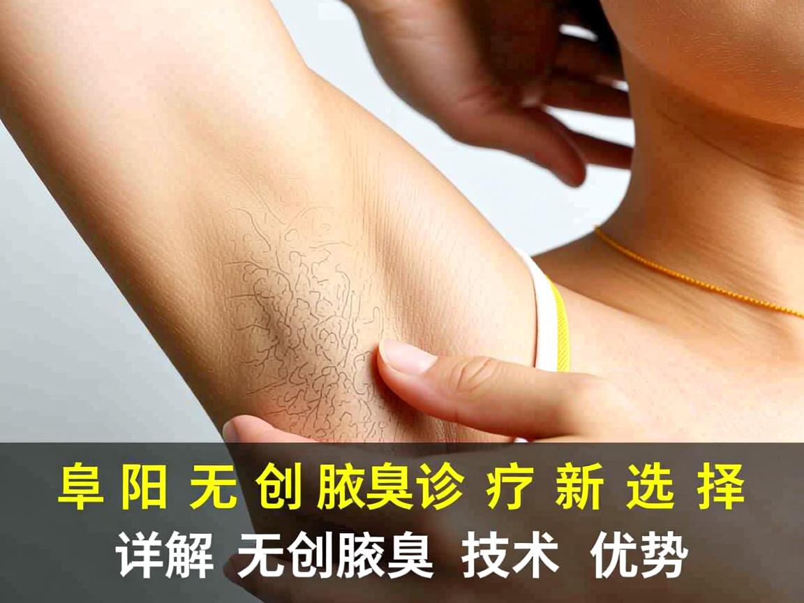 阜阳无创腋臭诊疗新选择，详解无创腋臭技术优势