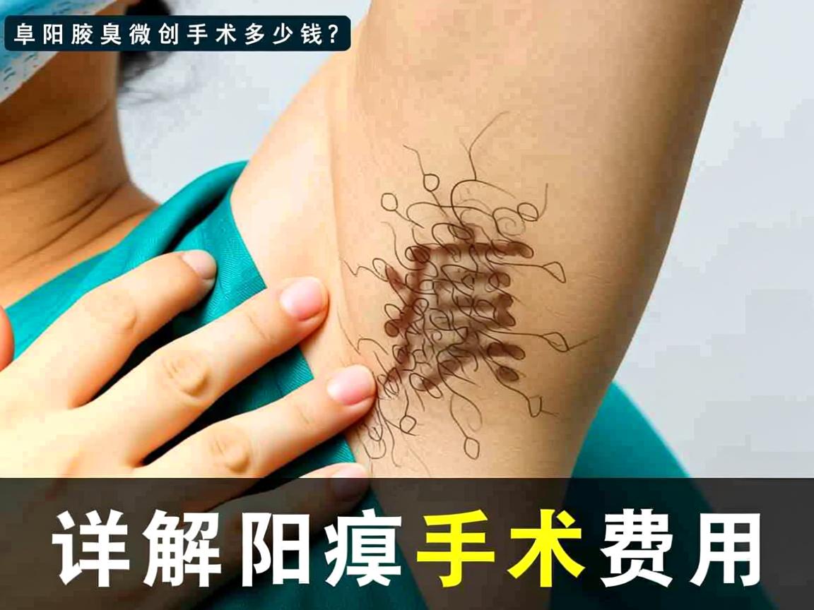 阜阳腋臭微创手术多少钱?详解阜阳腋臭手术费用 阜阳腋臭微创手术多少钱?详解阜阳腋臭手术费用